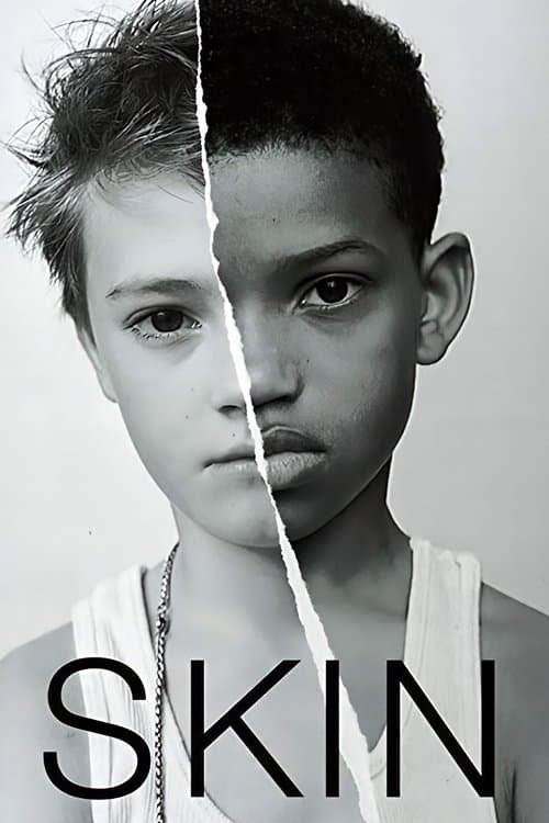 Póster de Skin